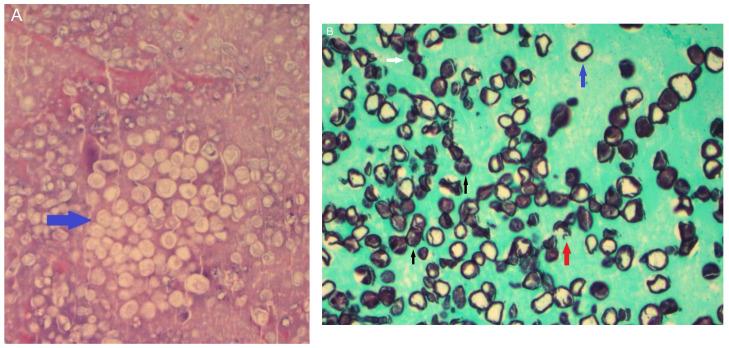 https://cdn.ncbi.nlm.nih.gov/pmc/blobs/aa51/11508864/f305ccd9f6ea/jof-10-00724-g014.jpg