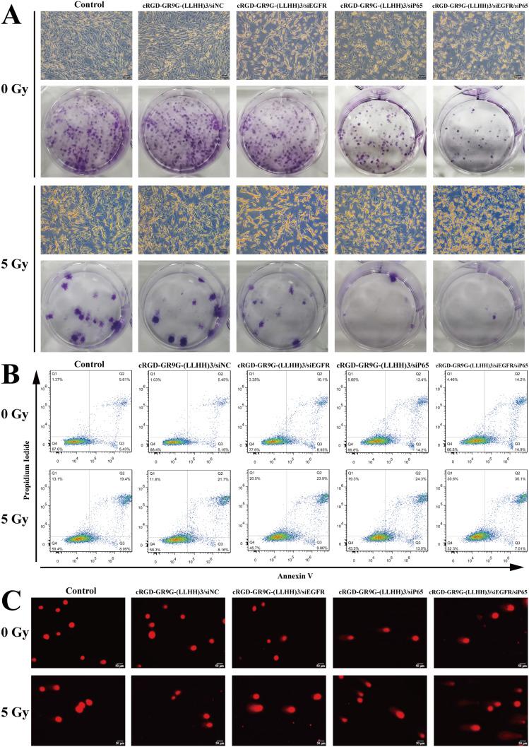 https://cdn.ncbi.nlm.nih.gov/pmc/blobs/aa52/11559232/5a151554770e/IJN-19-11517-g0004.jpg