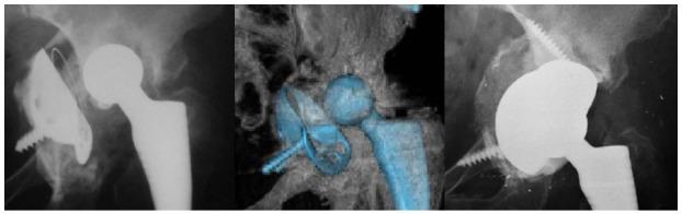 https://cdn.ncbi.nlm.nih.gov/pmc/blobs/aa53/5534404/362068cb76ba/WJO-8-553-g005.jpg