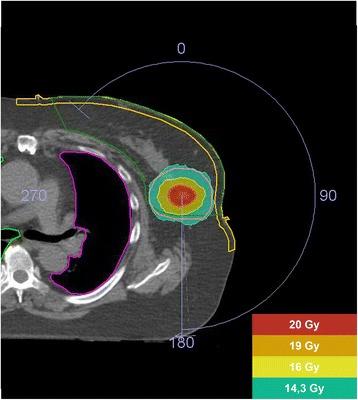 https://cdn.ncbi.nlm.nih.gov/pmc/blobs/aa55/5343419/a4ff8d9f4b05/12885_2017_3144_Fig3_HTML.jpg