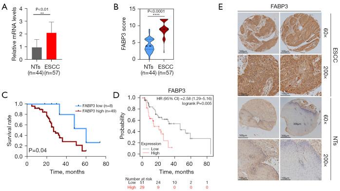 https://cdn.ncbi.nlm.nih.gov/pmc/blobs/aa56/12335710/b0f3cb0d0627/tcr-14-07-4305-f6.jpg