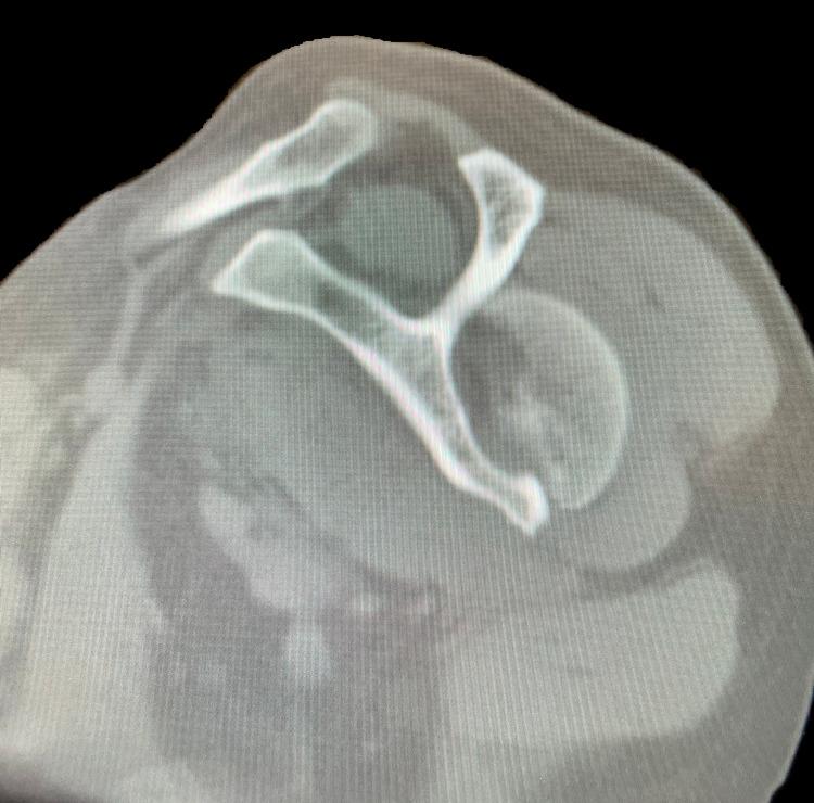 https://cdn.ncbi.nlm.nih.gov/pmc/blobs/aa5f/8487633/5e7faf8744c6/cureus-0013-00000017688-i06.jpg
