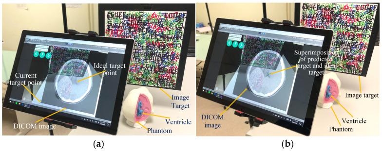 https://cdn.ncbi.nlm.nih.gov/pmc/blobs/aa62/10215407/01043ac77821/bioengineering-10-00617-g002.jpg