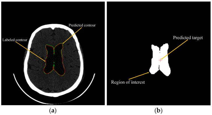 https://cdn.ncbi.nlm.nih.gov/pmc/blobs/aa62/10215407/37d739dd7038/bioengineering-10-00617-g004.jpg