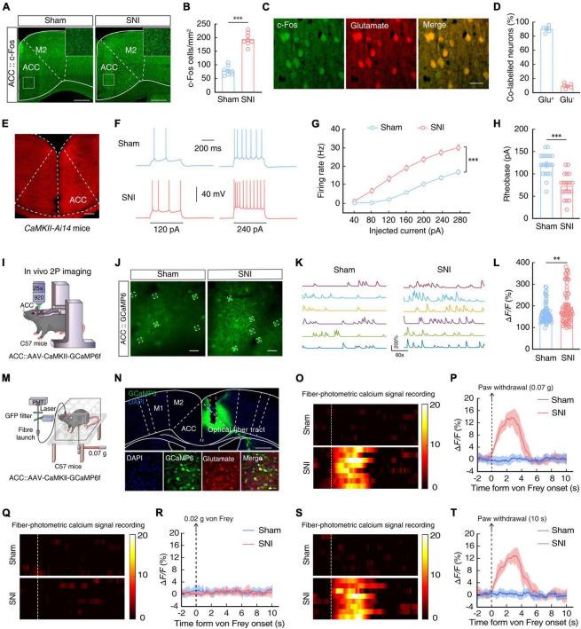 https://cdn.ncbi.nlm.nih.gov/pmc/blobs/aa62/10285483/553c20d85a25/fncel-17-1140769-g002.jpg