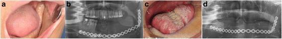 https://cdn.ncbi.nlm.nih.gov/pmc/blobs/aa62/5117542/e34cef966a6e/12957_2016_1043_Fig5_HTML.jpg