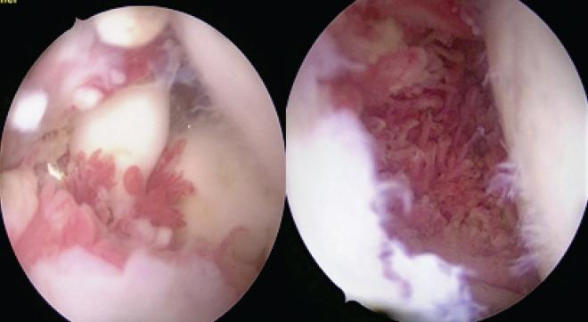 https://cdn.ncbi.nlm.nih.gov/pmc/blobs/aa66/8046480/32222c4986d3/JOCR-11-59-g005.jpg