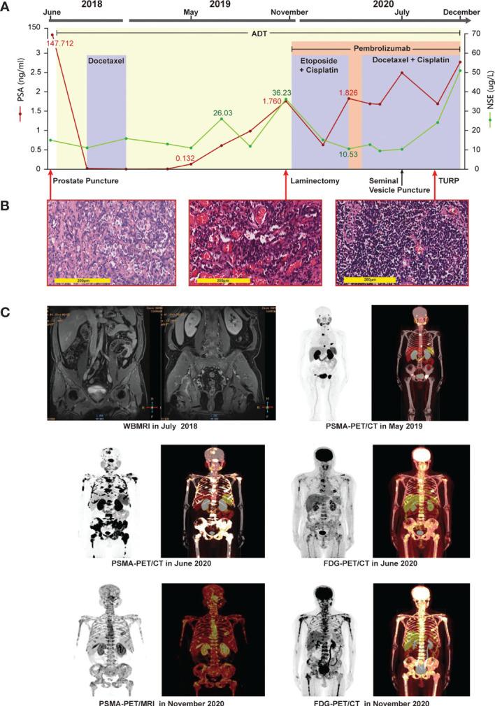 https://cdn.ncbi.nlm.nih.gov/pmc/blobs/aa69/8503647/0f2de5fe7903/fonc-11-732071-g001.jpg