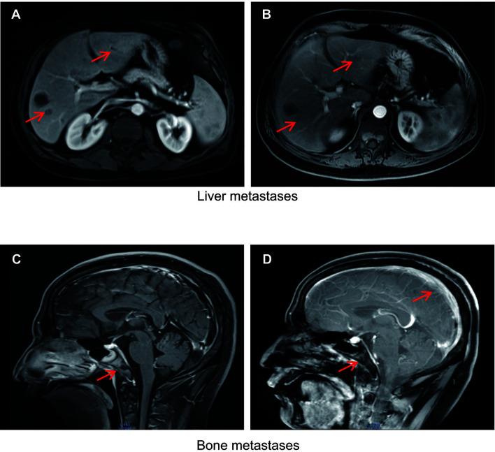 https://cdn.ncbi.nlm.nih.gov/pmc/blobs/aa69/8503647/298b6558d47e/fonc-11-732071-g002.jpg