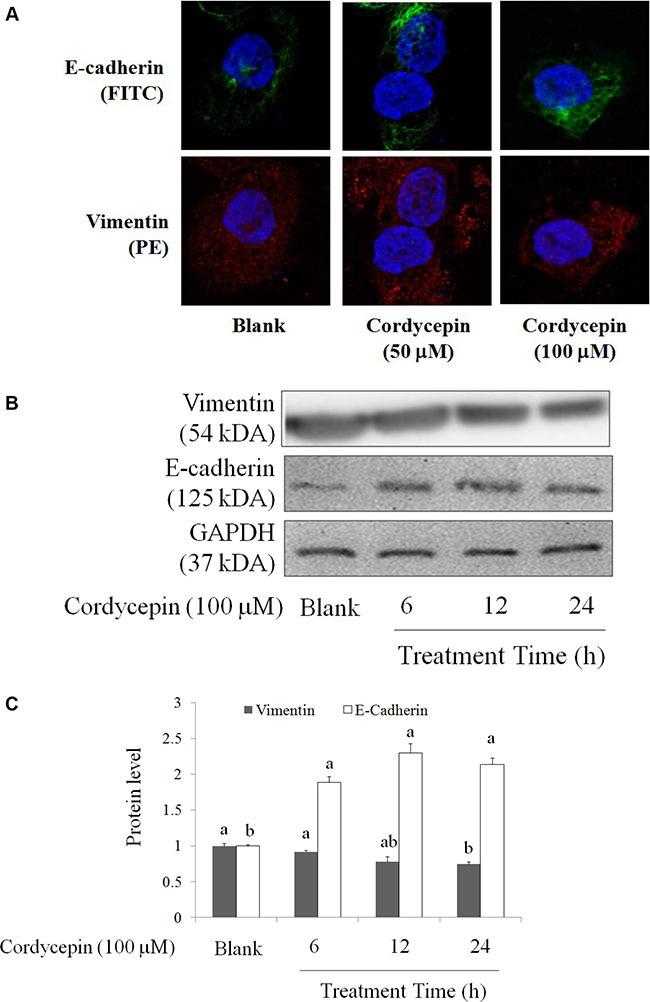 https://cdn.ncbi.nlm.nih.gov/pmc/blobs/aa6e/5356863/6652b9c57da6/oncotarget-08-3049-g003.jpg