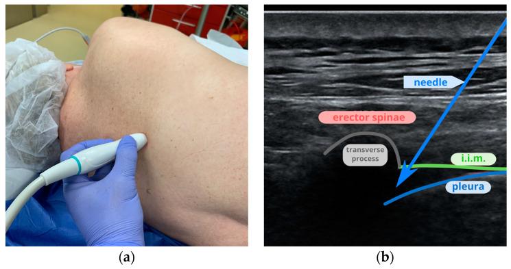 https://cdn.ncbi.nlm.nih.gov/pmc/blobs/aa71/11355155/6382422b167b/jcm-13-04836-g004.jpg