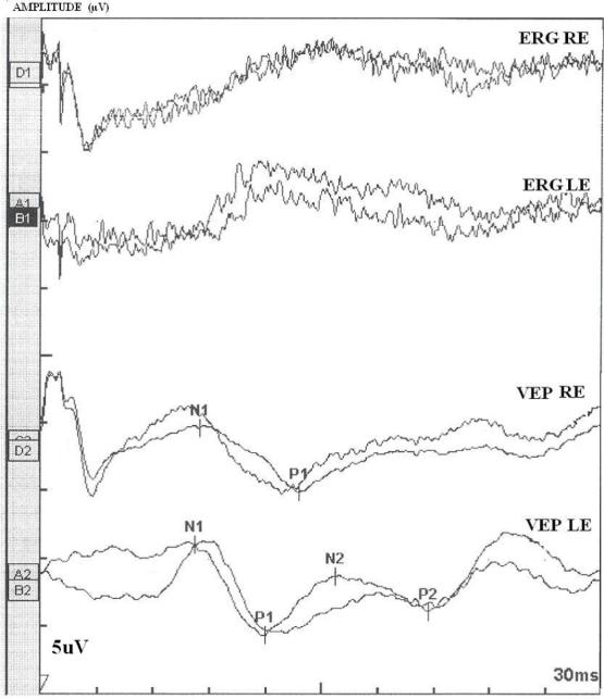 https://cdn.ncbi.nlm.nih.gov/pmc/blobs/aa73/2538493/b77918e310e5/mv-v14-1719-f4.jpg