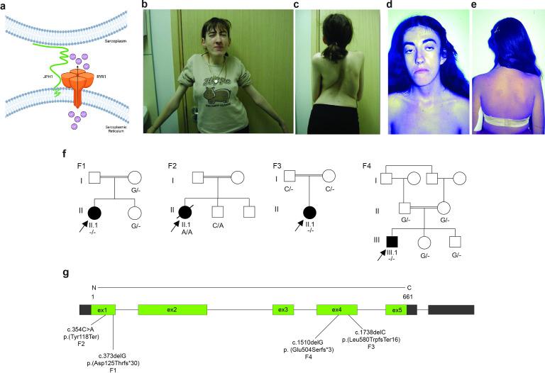 https://cdn.ncbi.nlm.nih.gov/pmc/blobs/aa7b/11503096/233d3b197843/jmg-61-10-g001.jpg