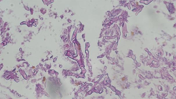 https://cdn.ncbi.nlm.nih.gov/pmc/blobs/aa7c/12086647/2f37d3cc20f3/HSR2-8-e70831-g002.jpg