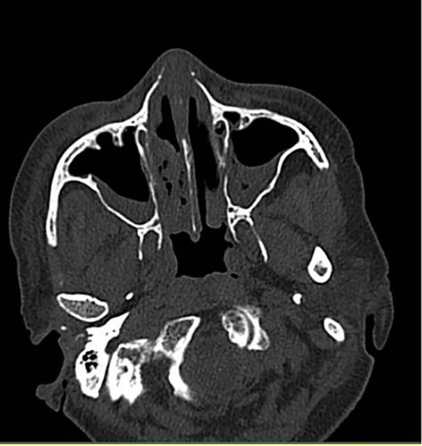 https://cdn.ncbi.nlm.nih.gov/pmc/blobs/aa7c/12086647/5c2a587f4730/HSR2-8-e70831-g003.jpg