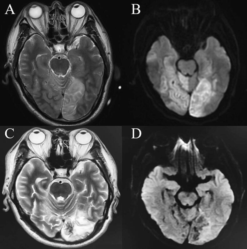 https://cdn.ncbi.nlm.nih.gov/pmc/blobs/aa83/10509878/c188584e92b8/gr2.jpg