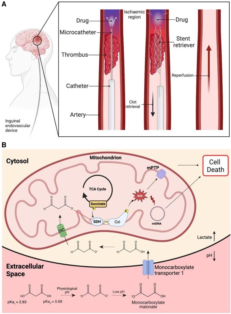 https://cdn.ncbi.nlm.nih.gov/pmc/blobs/aa89/12352302/ef6c4b04990d/cvaf118f1.jpg