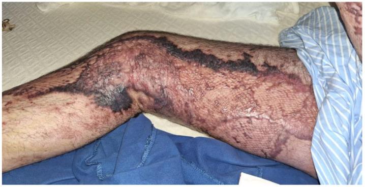 https://cdn.ncbi.nlm.nih.gov/pmc/blobs/aa8b/11356184/b9eaa62ce6c8/medicina-60-01201-g003.jpg