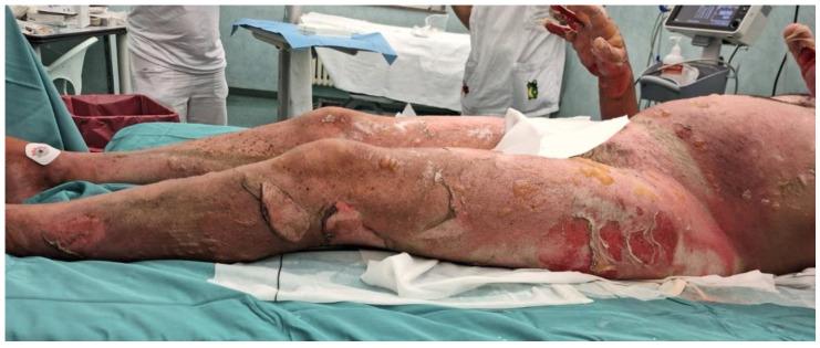 https://cdn.ncbi.nlm.nih.gov/pmc/blobs/aa8b/11356184/fc01a01fff0b/medicina-60-01201-g002.jpg