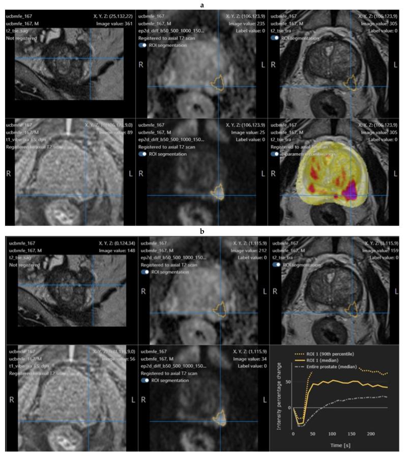 https://cdn.ncbi.nlm.nih.gov/pmc/blobs/aa8e/9415513/b25489aadd7e/tomography-08-00168-g001.jpg