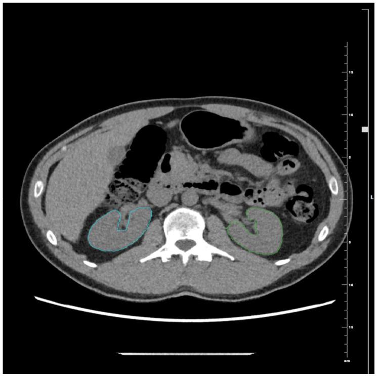 https://cdn.ncbi.nlm.nih.gov/pmc/blobs/aa93/12387138/24144d390d2a/jcm-14-05888-g005.jpg