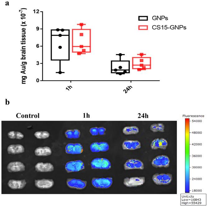 https://cdn.ncbi.nlm.nih.gov/pmc/blobs/aa97/11919634/658e8fa1da44/CNS-31-e70263-g002.jpg