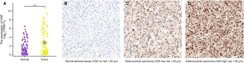 https://cdn.ncbi.nlm.nih.gov/pmc/blobs/aa99/12043488/246bfe0c1017/fimmu-16-1542780-g002.jpg