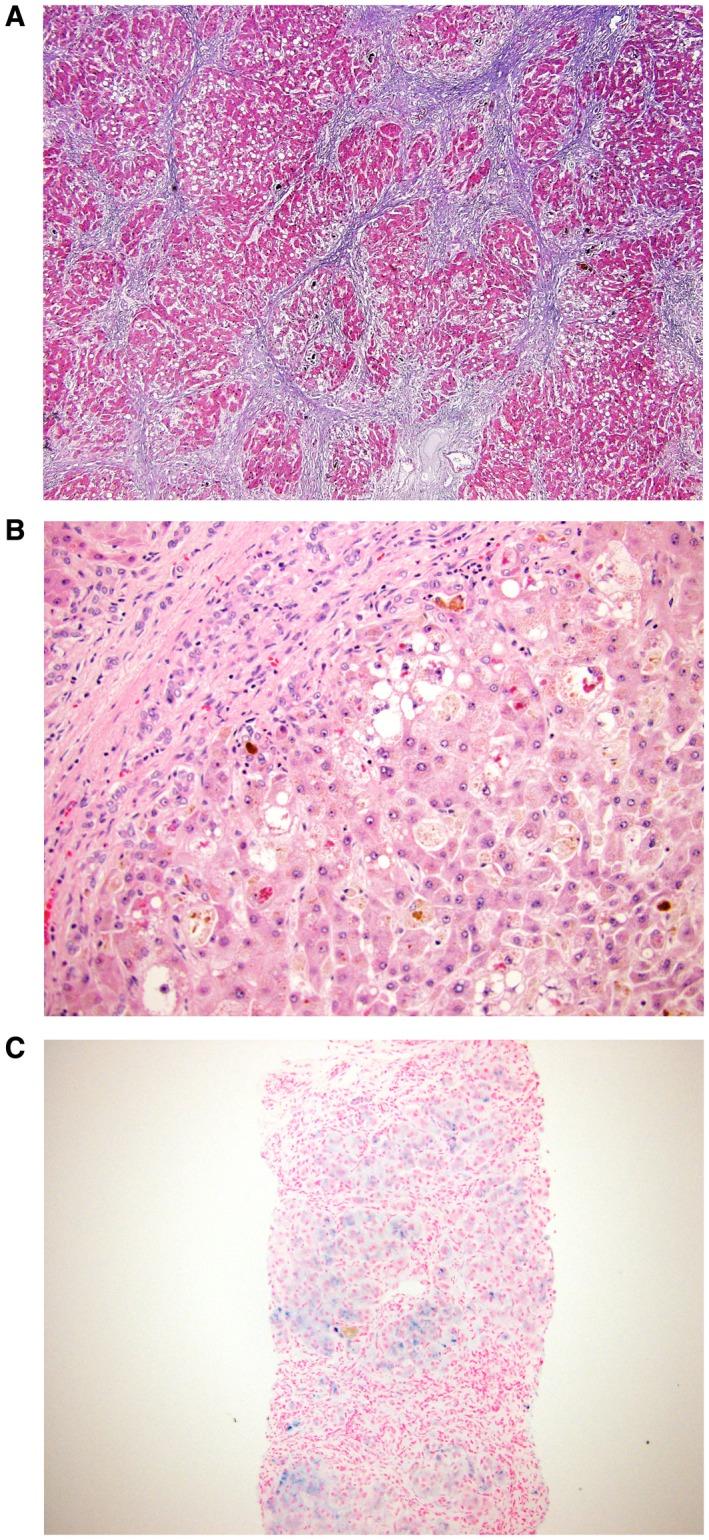https://cdn.ncbi.nlm.nih.gov/pmc/blobs/aa9a/6671688/ac8776d80d52/HEP4-3-1159-g001.jpg