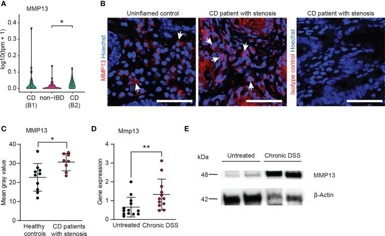 https://cdn.ncbi.nlm.nih.gov/pmc/blobs/aa9d/10189878/49e008388130/fimmu-14-1163198-g002.jpg