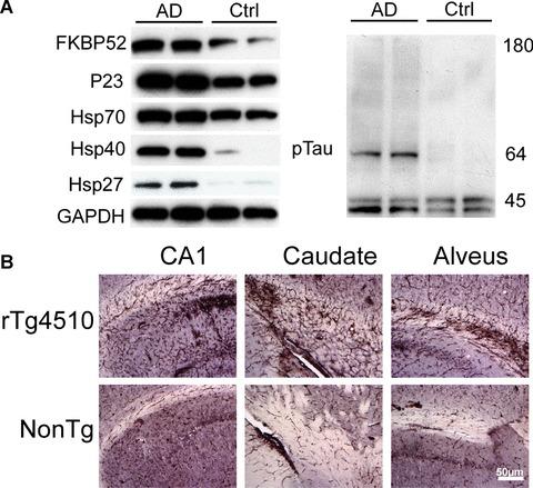 https://cdn.ncbi.nlm.nih.gov/pmc/blobs/aaa2/3822869/212101860c3d/jcmm0013-0619-f1.jpg