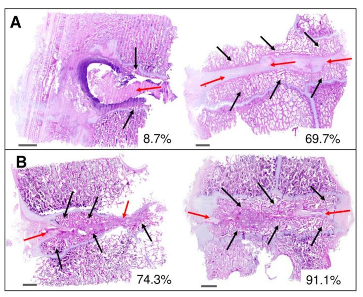 https://cdn.ncbi.nlm.nih.gov/pmc/blobs/aaa5/8301420/220020e5b998/biomedicines-09-00733-g011.jpg
