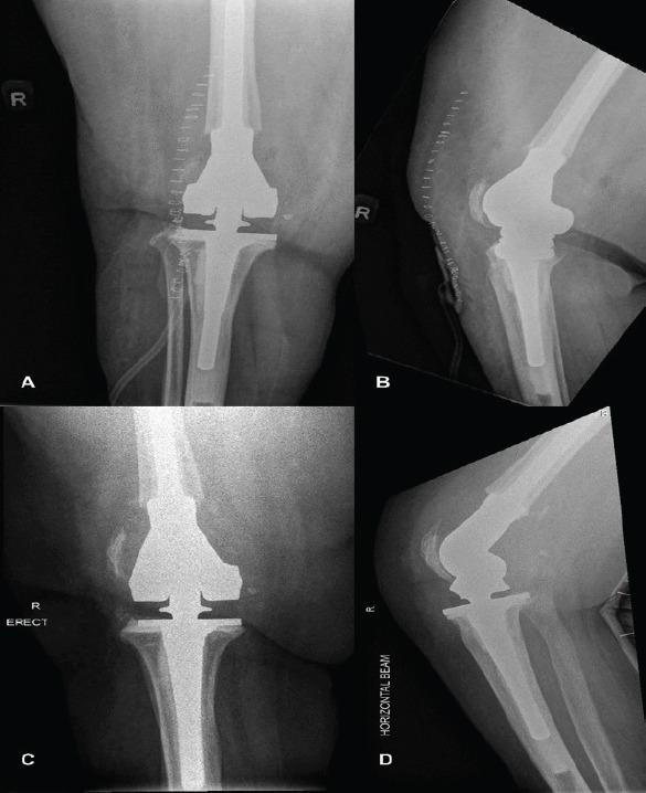 https://cdn.ncbi.nlm.nih.gov/pmc/blobs/aaae/11043965/fc1d4decc879/JOCR-14-78-g005.jpg