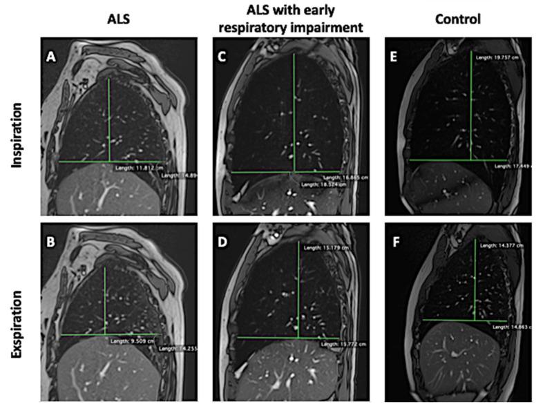https://cdn.ncbi.nlm.nih.gov/pmc/blobs/aaaf/11172785/7c09b741bc1a/jcm-13-03103-g003.jpg