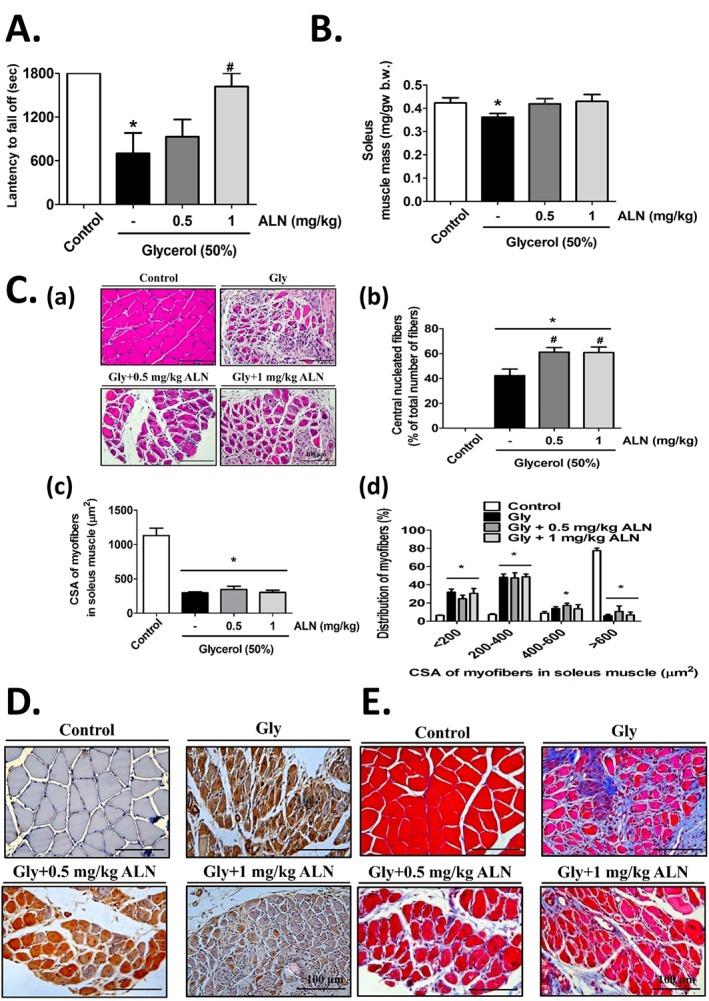 https://cdn.ncbi.nlm.nih.gov/pmc/blobs/aab0/5989760/1117882381c3/JCSM-9-585-g009.jpg