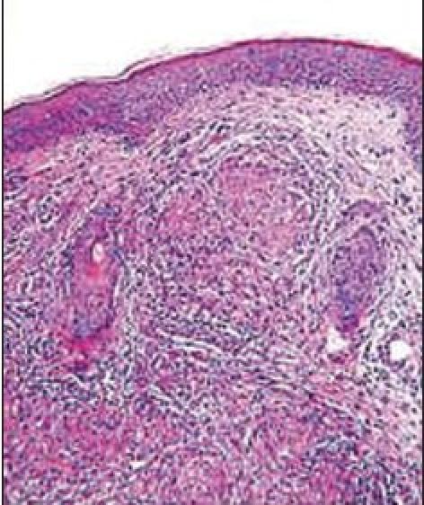 https://cdn.ncbi.nlm.nih.gov/pmc/blobs/aab3/3221221/32527be28187/IJD-56-550-g002.jpg