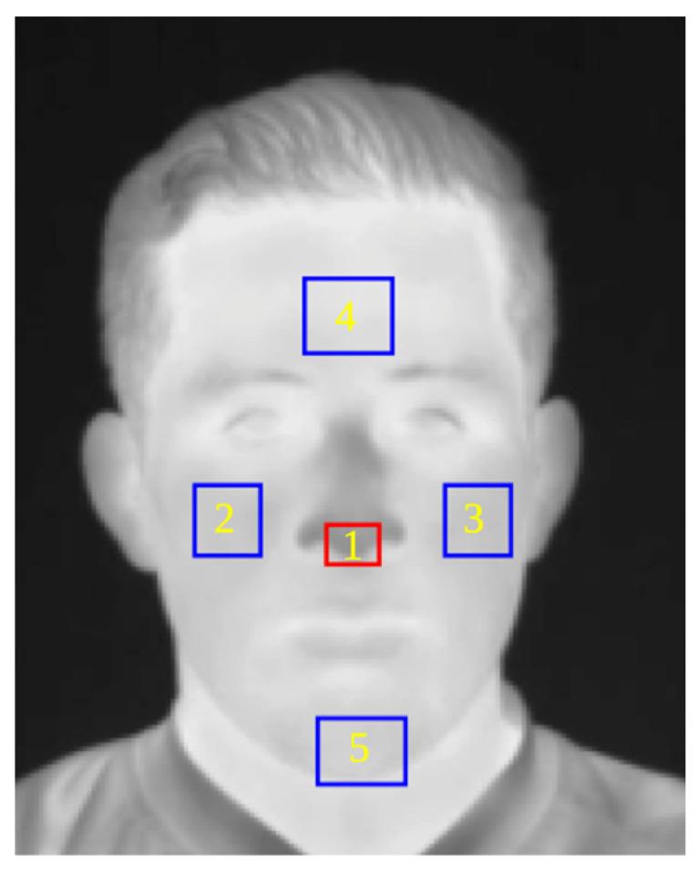 https://cdn.ncbi.nlm.nih.gov/pmc/blobs/aabb/10781318/3fd839fc2316/sensors-24-00152-g003.jpg
