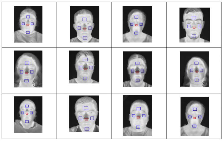 https://cdn.ncbi.nlm.nih.gov/pmc/blobs/aabb/10781318/719023b53dc9/sensors-24-00152-g008.jpg
