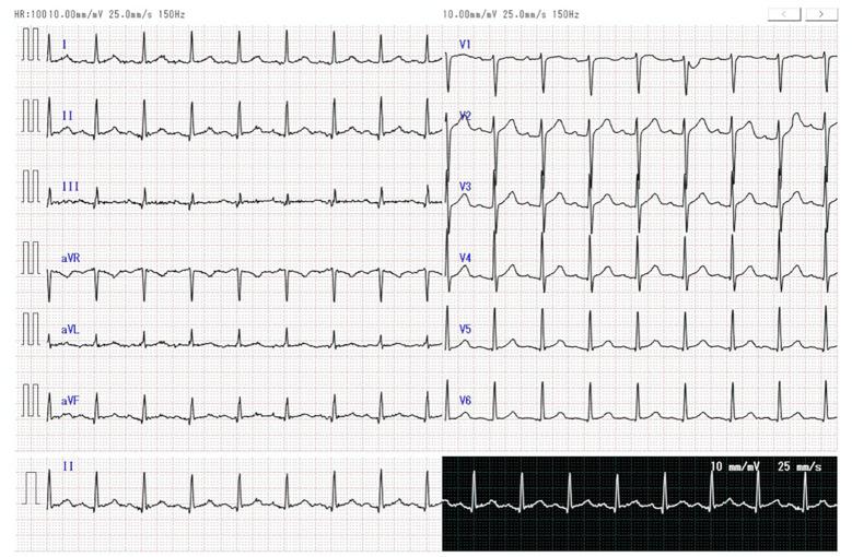 https://cdn.ncbi.nlm.nih.gov/pmc/blobs/aabb/8429293/873ffac140fc/1349-7235-60-2623-g002.jpg