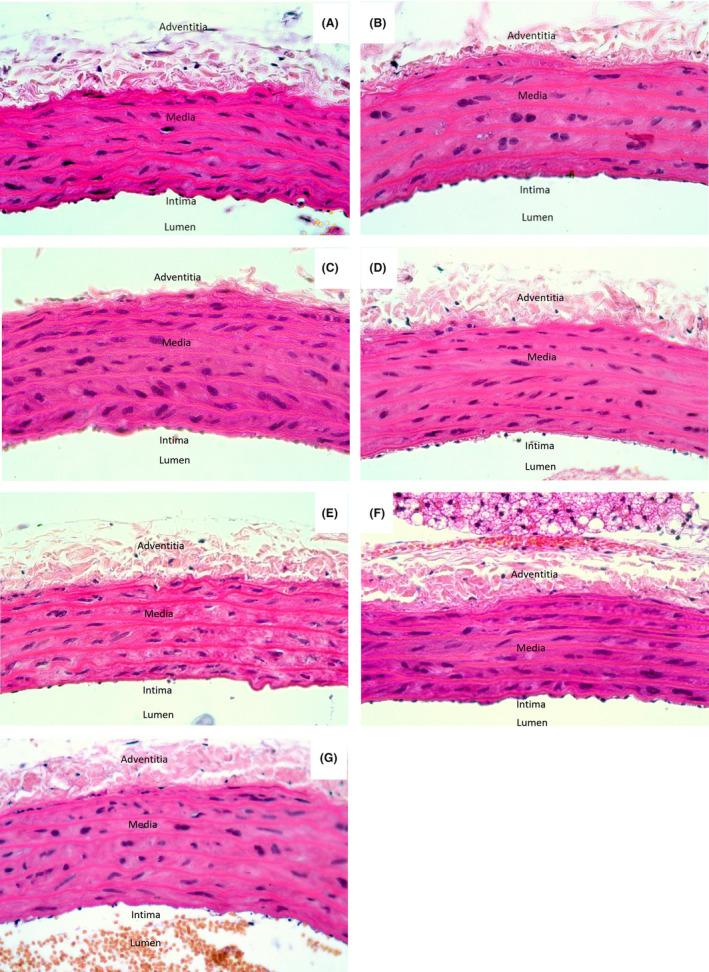 https://cdn.ncbi.nlm.nih.gov/pmc/blobs/aabc/10951418/b6573b1a73b9/PRP2-12-e1189-g001.jpg