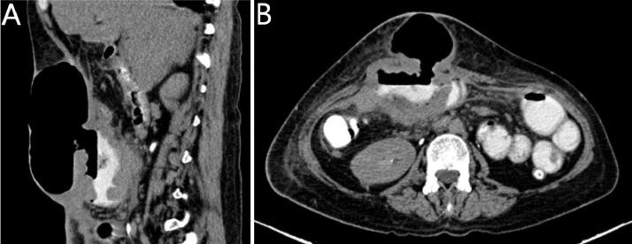 https://cdn.ncbi.nlm.nih.gov/pmc/blobs/aabd/8403721/3120fe96be18/gr6.jpg