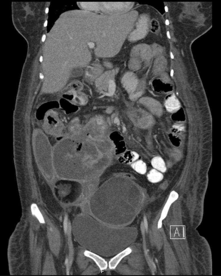 https://cdn.ncbi.nlm.nih.gov/pmc/blobs/aabd/8403721/725faf2eb664/gr3.jpg
