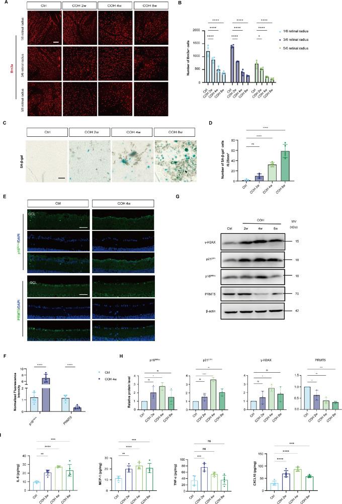 https://cdn.ncbi.nlm.nih.gov/pmc/blobs/aac6/12136124/ab01fb7aa3bc/iovs-66-6-8-f001.jpg