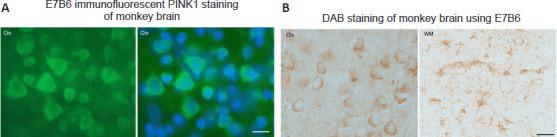 https://cdn.ncbi.nlm.nih.gov/pmc/blobs/aac8/11438320/1ea50a54742c/NRR-20-1124-g004.jpg