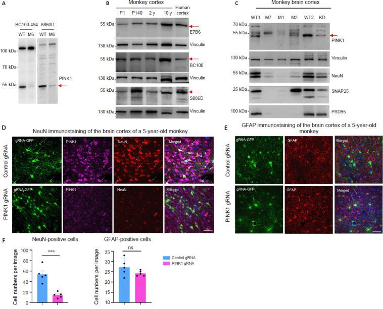 https://cdn.ncbi.nlm.nih.gov/pmc/blobs/aac8/11438320/80170ba5c58e/NRR-20-1124-g003.jpg