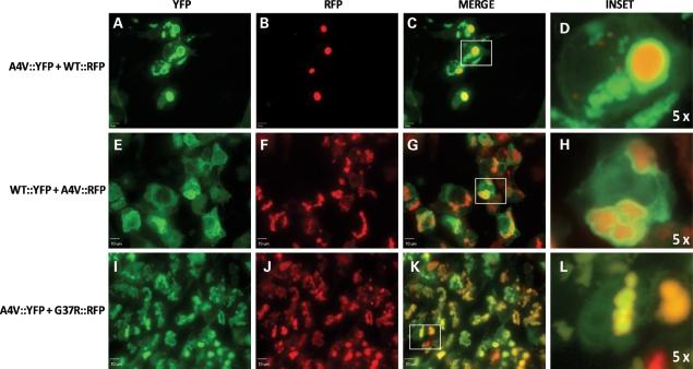 https://cdn.ncbi.nlm.nih.gov/pmc/blobs/aad6/2989888/ad84c7b02141/ddq40809.jpg