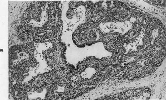 https://cdn.ncbi.nlm.nih.gov/pmc/blobs/aad7/1942746/94d8b272a2a6/amjpathol00606-0202-a.jpg