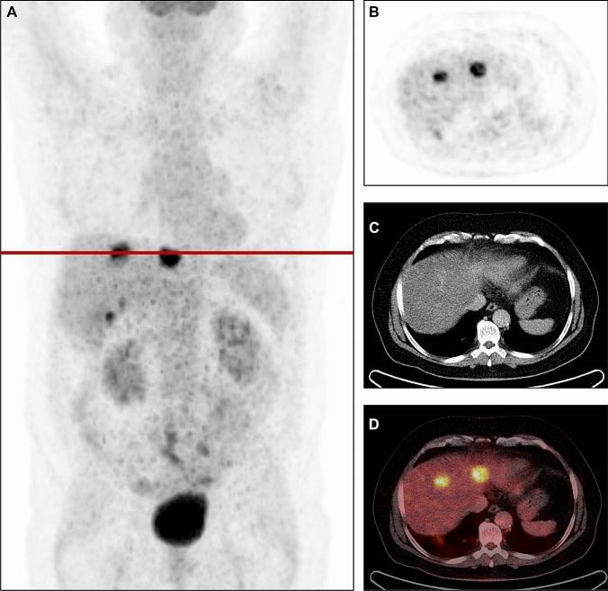 https://cdn.ncbi.nlm.nih.gov/pmc/blobs/aade/9668778/6a20f6247764/12149_2022_1796_Fig3_HTML.jpg