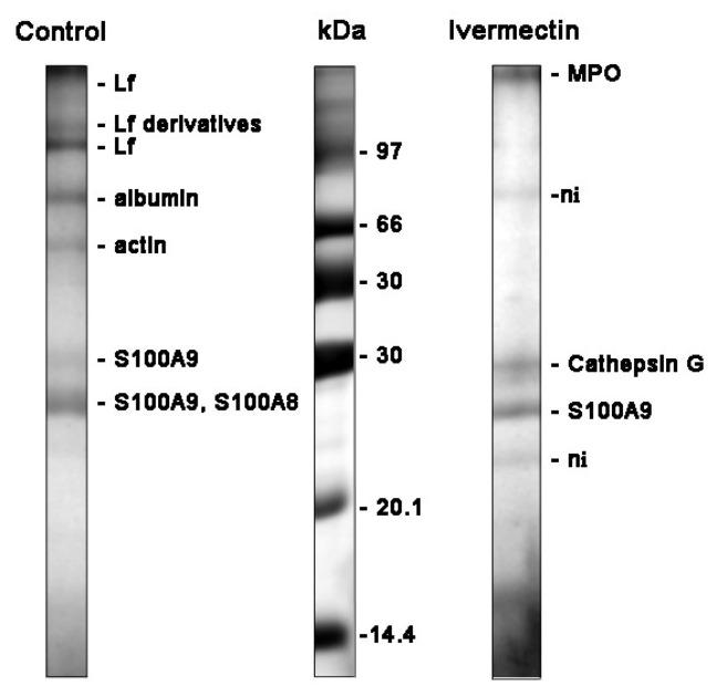 https://cdn.ncbi.nlm.nih.gov/pmc/blobs/aade/9775137/9761e576b01d/biomedicines-10-03284-g006.jpg