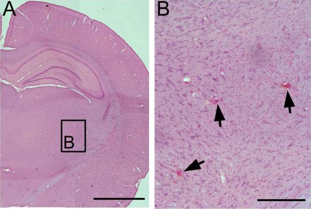 https://cdn.ncbi.nlm.nih.gov/pmc/blobs/aae3/5657739/e3984ad964b2/10.1177_0963689717715824-fig4.jpg