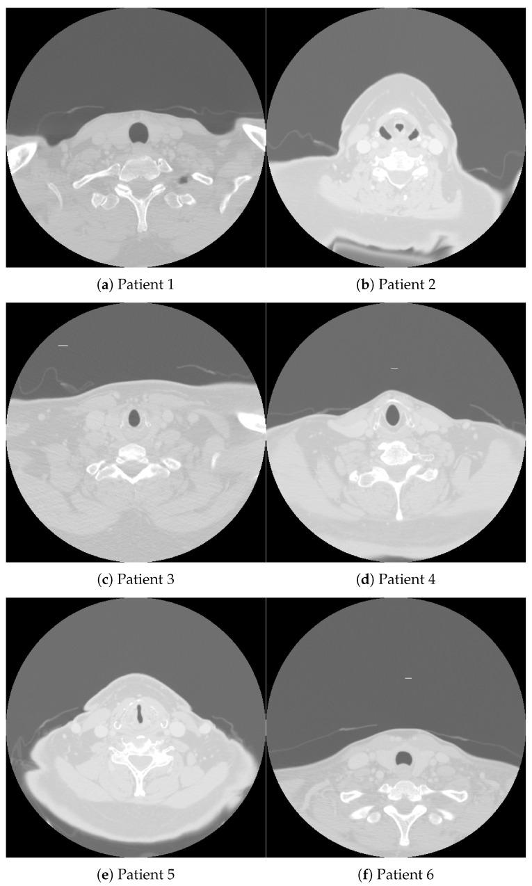 https://cdn.ncbi.nlm.nih.gov/pmc/blobs/aae4/11430806/3ff617354718/curroncol-31-00389-g001.jpg